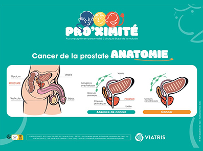 Planche Anatomique de la prostate